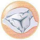 心室支架说明书,这份通俗易懂的心室说明书请收好