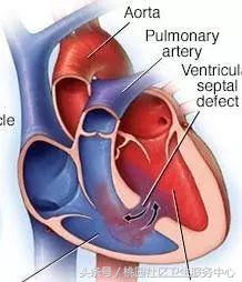 心室支架说明书,这份通俗易懂的心室说明书请收好