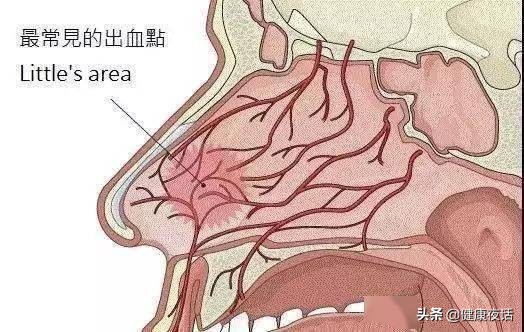 孩子流鼻血怎么办最有效的方法,孩子流鼻血怎么办最有效方法