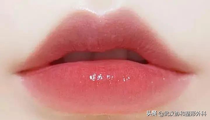 常见的唇部整形都有哪些,常见的唇部整形有哪些