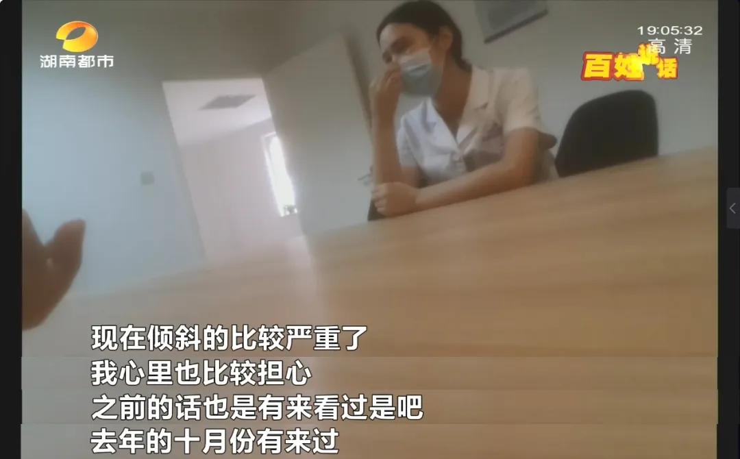 隆鼻后怀孕假体外露,女子怀孕鼻子假体外露