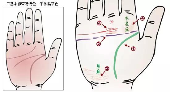 掌纹诊病图片,掌纹能查出糖尿病吗