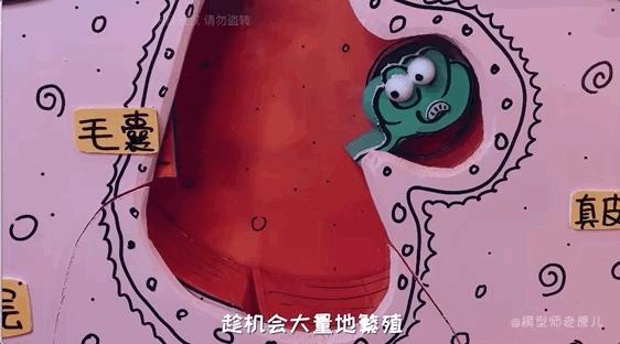 模型师老原儿手被烫伤,模型师老原儿被烫伤