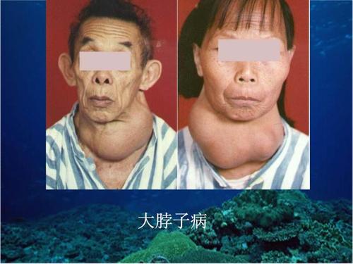 一招分辨出真假碘盐