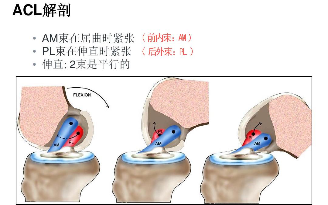 前叉重建单束可以满足运动要求么,前叉重建有几个切口
