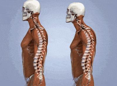 真翘臀和假翘臀怎么辨别,翘臀本来就有点骨盆前倾吗