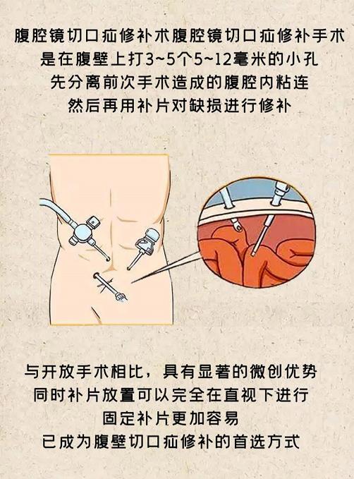 董擂大连医院,疝外科名医
