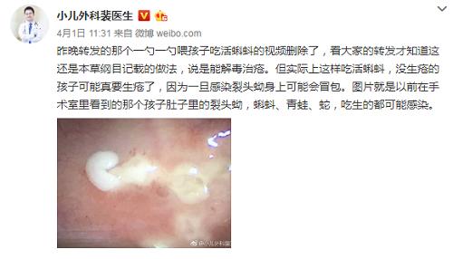 蝌蚪生吃偏方,小蝌蚪生吃是什么偏方