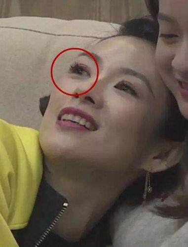 被双眼皮贴坑了的女星们,明星双眼皮李小璐