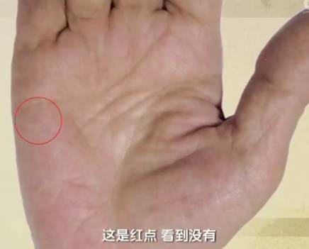 手健康有多重要,手型看健康