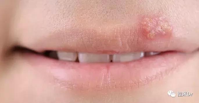 皮肤问题七大困扰,让人懊恼的问题
