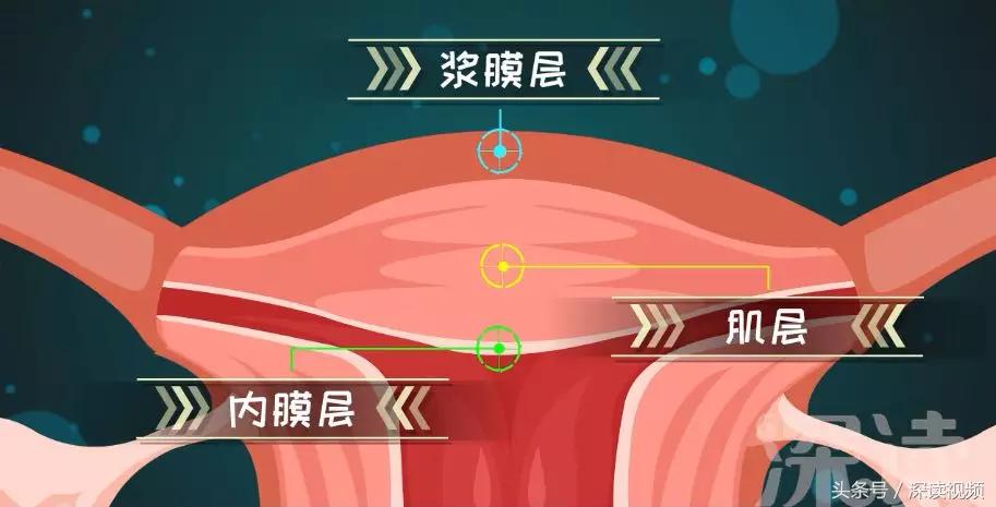 子宫肌瘤在哪个地方影响怀孕,子宫肌瘤剔除怎么还有东西流出来