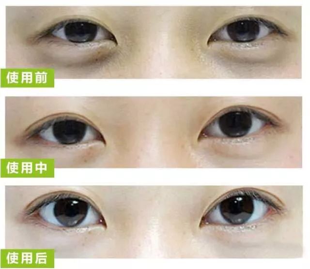 女生眼睛小用什么会变大,眼睛小的女生变漂亮