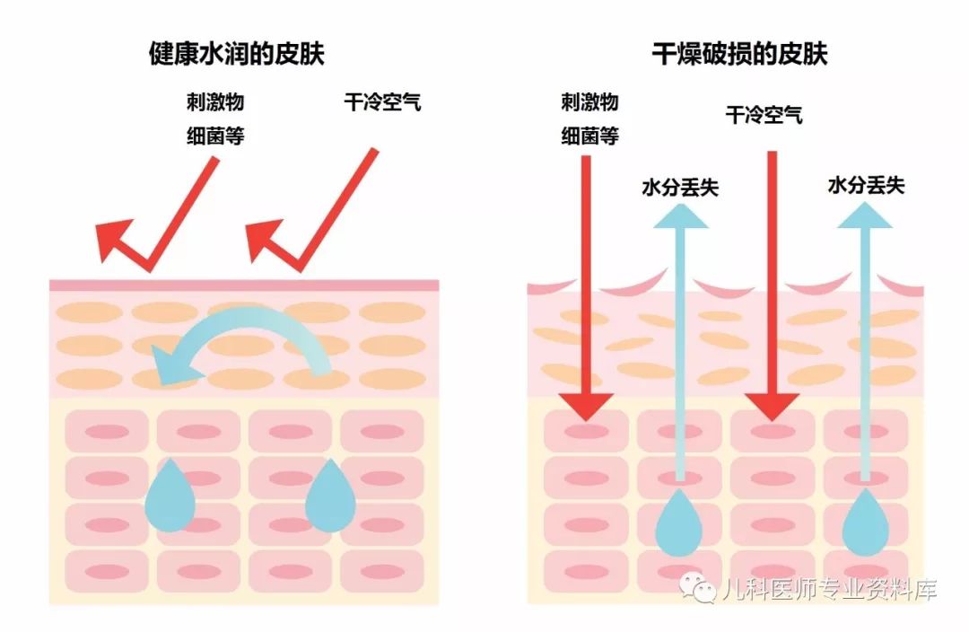 痱子和湿疹混合一起了怎么办,痱子和湿疹同时治疗用什么药