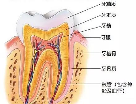 蛀牙是虫蛀的吗动画,蛀牙真的是虫蛀的嘛