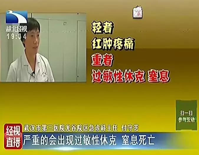 被蜂子蛰了输液,被蜂子蛰了24处伤口
