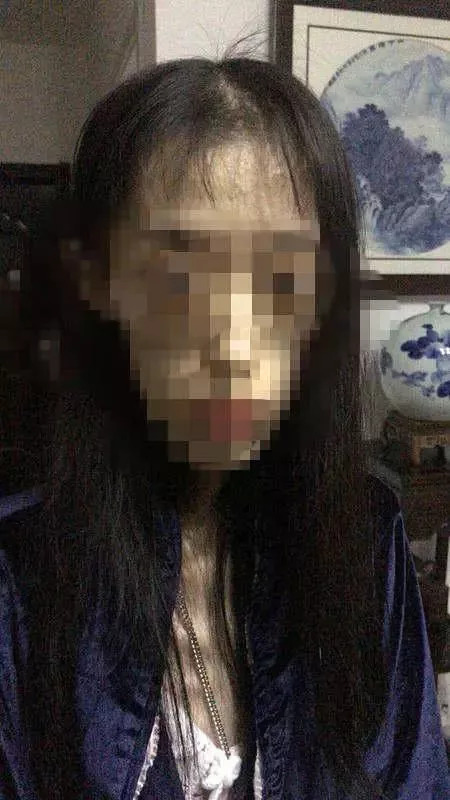 1米67才50斤！看完这个21岁女孩的故事，你还敢“自杀式”减肥吗？
