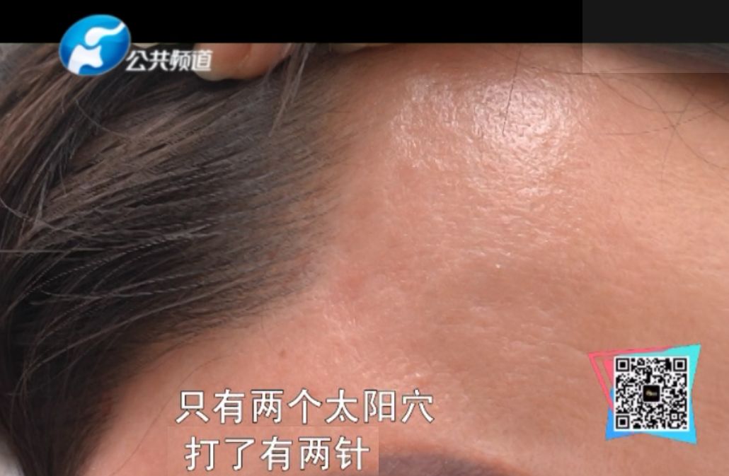 整容女被医生当场揭穿,郑州整形医院消费陷阱曝光