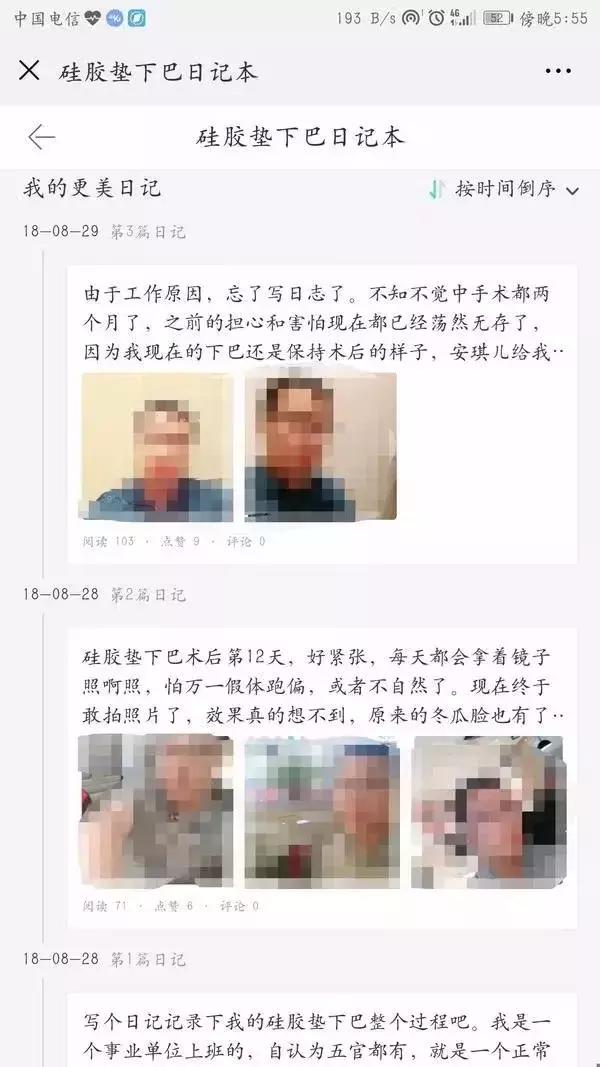 韩式整容全过程,日式整容和韩式整容
