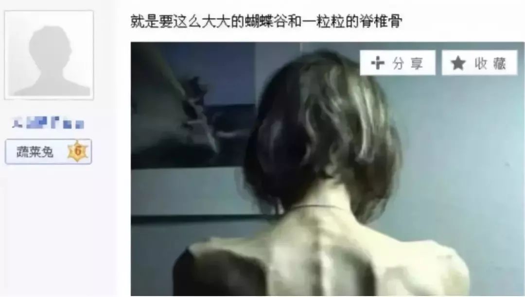 减肥把身体减坏的案例,年轻女性减肥的弊端