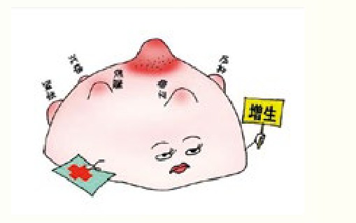 乳腺增生中药治疗法,乳腺结节增生中药可以治愈吗
