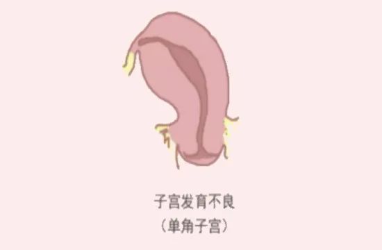 子宫的故事绘本,子宫畸形患者故事