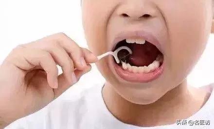 小孩乳牙龋齿要治么,小孩乳牙龋齿了需要治疗么