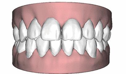 台风强风的危害有哪些呢,台风的危险有多可怕