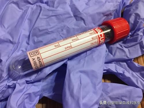 再障输注什么类型血,再障脐血移植所有过程