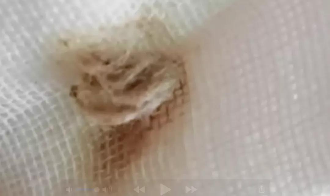妈妈发现女儿身上有血迹,母亲发现女儿身上散发臭味