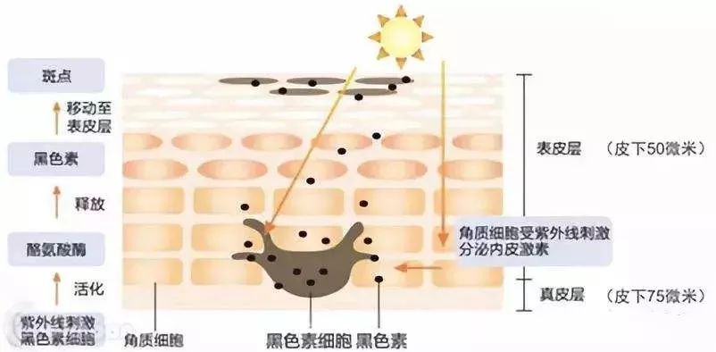 祛痘印小方法和步骤有哪些,痘印肌肤的护肤方法