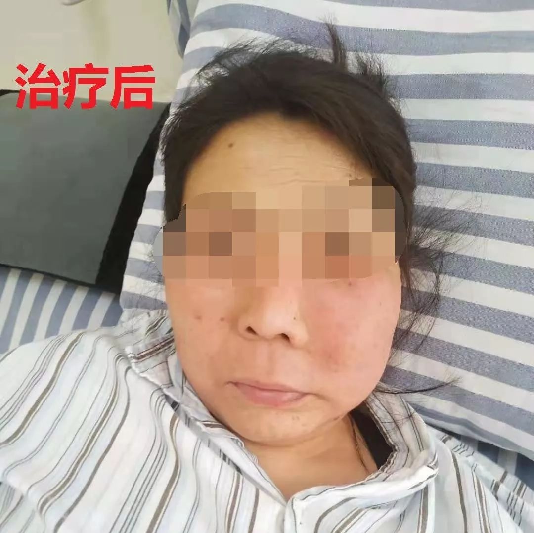 治病不一定非要打针吃药,治病最重要的是要治疗什么