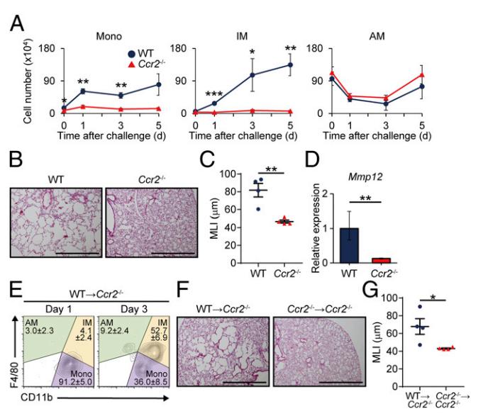 嗜碱性粒细胞0.08与肺结核有关吗,肺气肿与肺泡表面活性物质有关吗