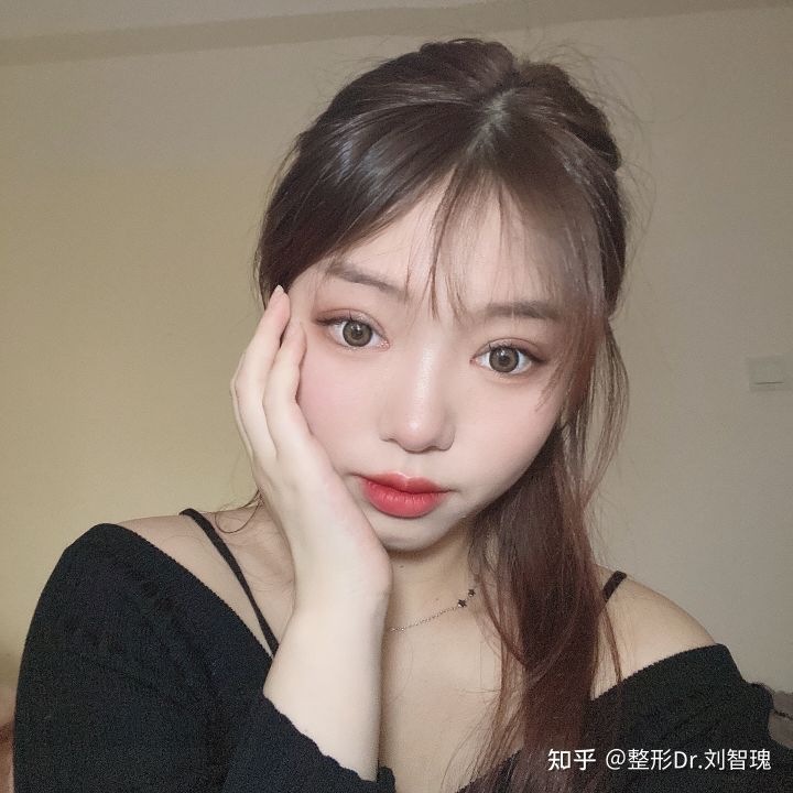 割双眼皮真的有必要吗,有必要割双眼皮吗