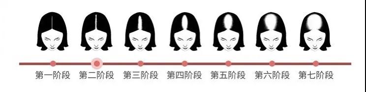 还在为脱发秃顶烦恼吗,还在为掉发脱发而烦恼吗