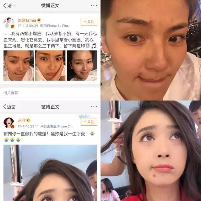 祛痘好物分享朋友圈怎么发,祛痘好物分享小学生
