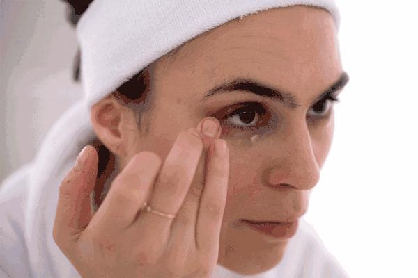 抗衰医美热拉提,热拉提抗衰