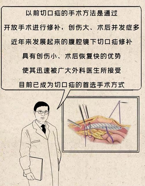 董擂大连医院,疝外科名医