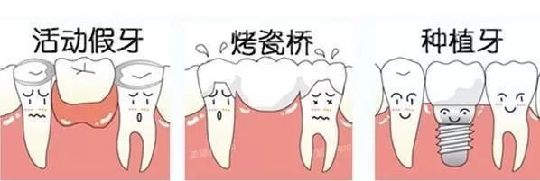 老不老关键是心态,牙齿怎么保护的四大方法