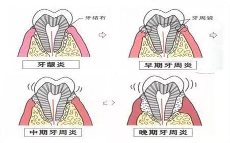大连齿医生口腔科普,大连齿医生口腔医院地址