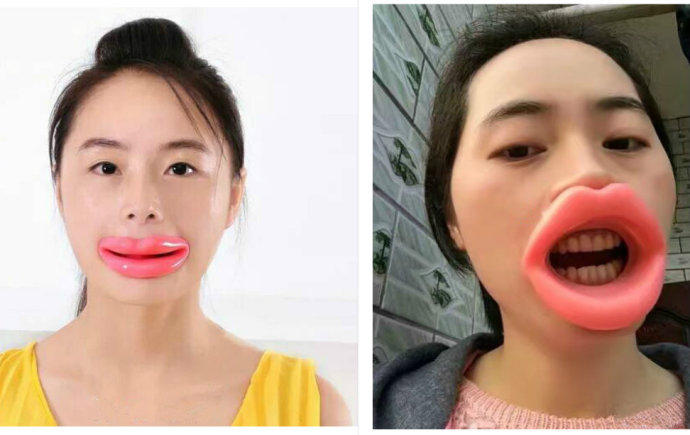 女生戴微笑练习器,女生戴微笑练习器一个月