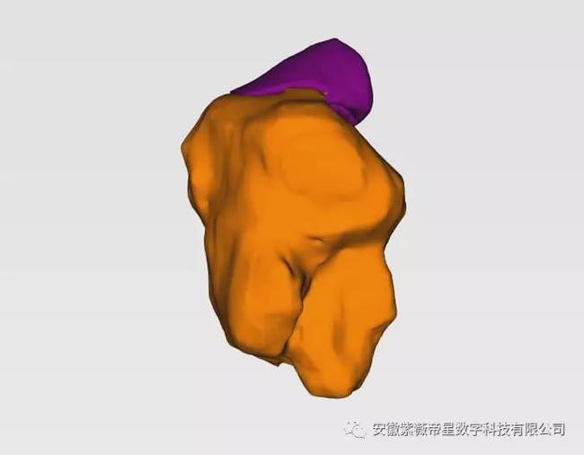 紫薇帝星穴,紫薇帝星医疗科技