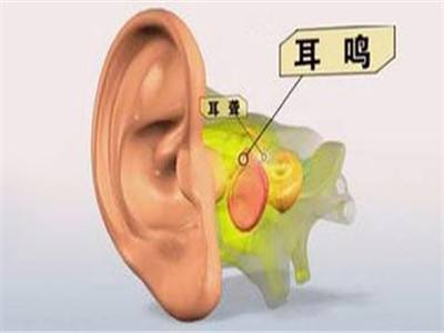 耳鸣其实是身体在警告你该休息了,耳鸣警惕脑供血不足