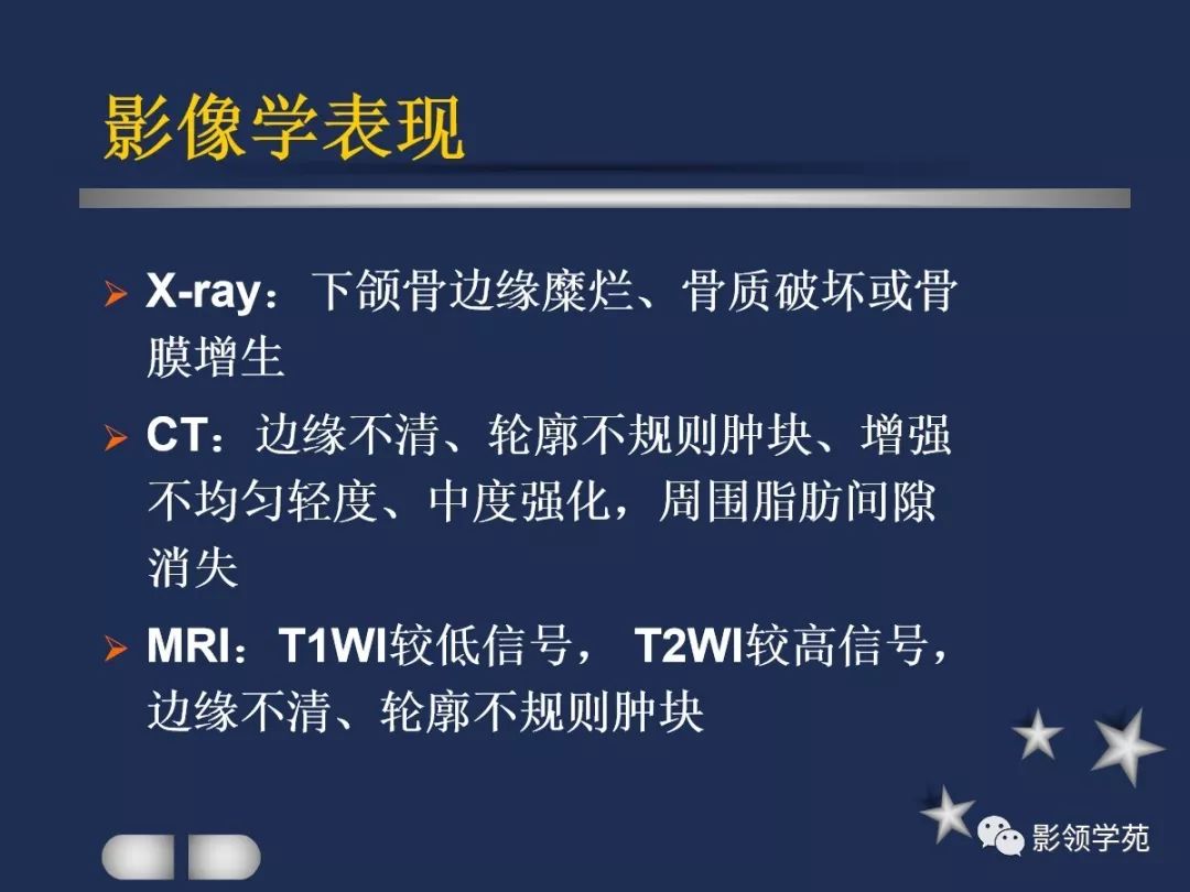 腮腺疾病影像学诊断,腮腺肿块影像诊断