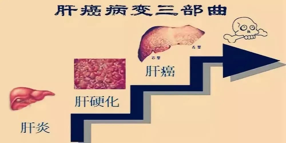 中国癌，中国治！中国首个肝癌免疫疗法——卡瑞利珠单抗获批