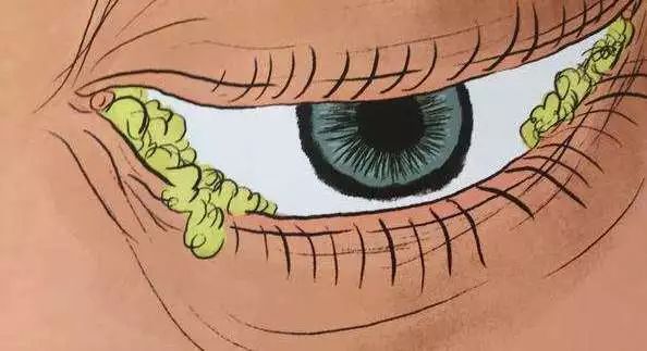 莫名流泪的预兆,莫名流泪的心理原因