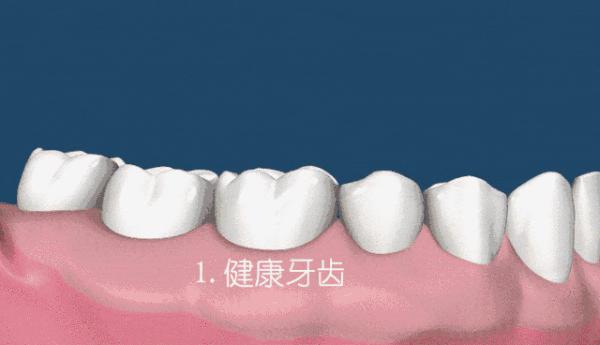 去除牙黄口臭牙膏实验,酵素牙膏去烟渍美白牙结石