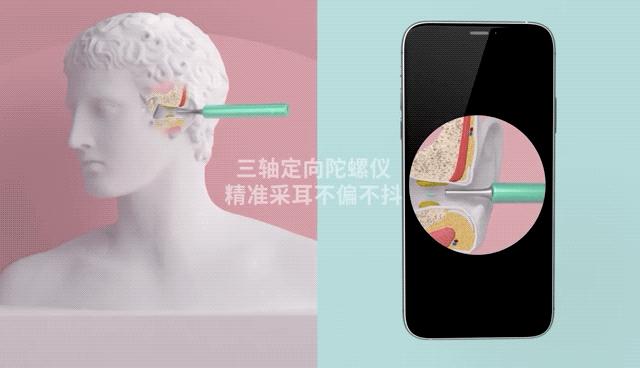 摄像头掏耳勺app,无线高清掏耳勺挖耳神器带摄像头