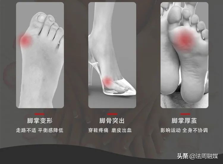 拇指长歪了？别慌！常德市第一中医医院专家帮您改“邪”归正