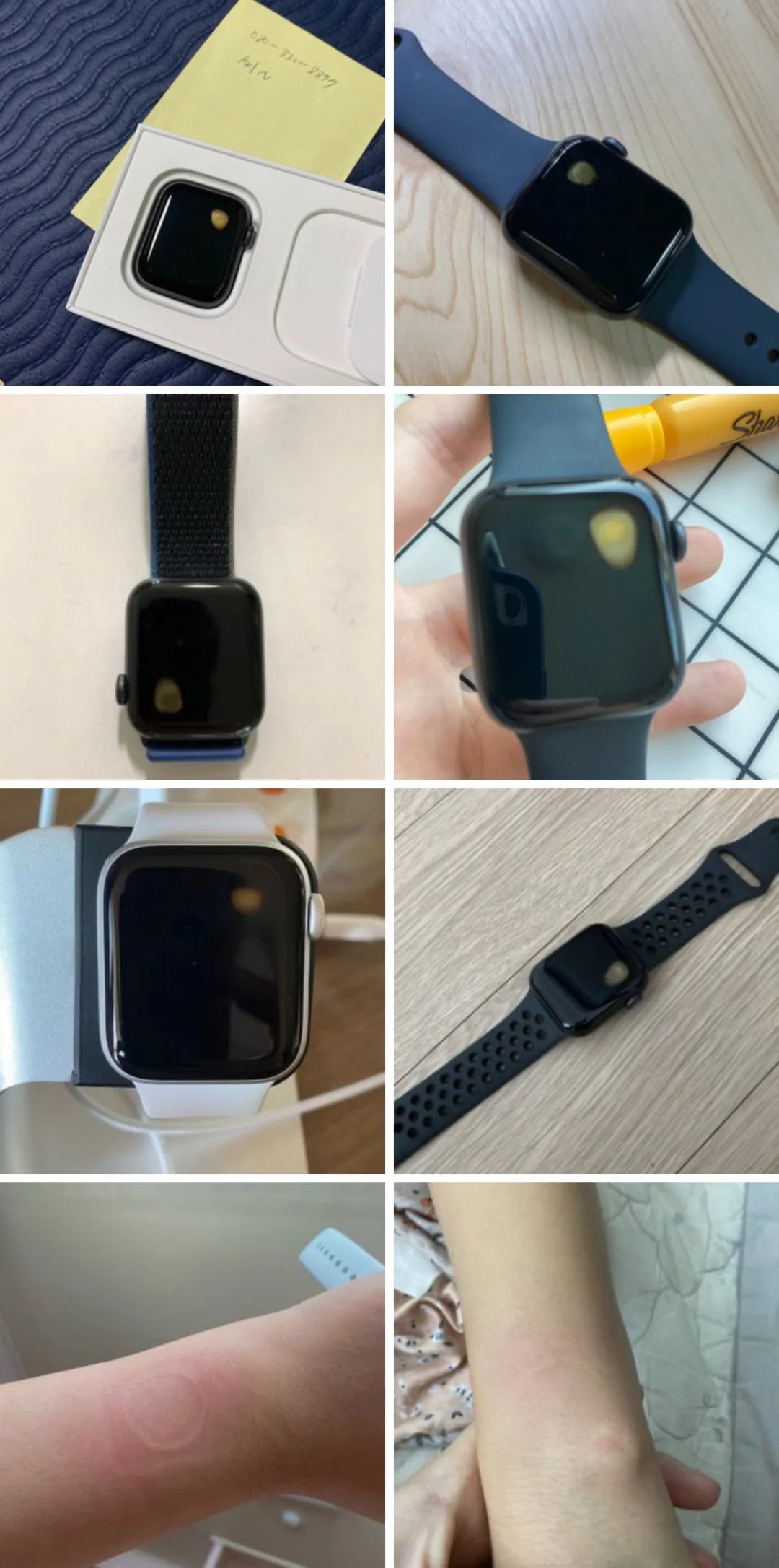 applewatchse支持手段温度吗,applewatchse发烧